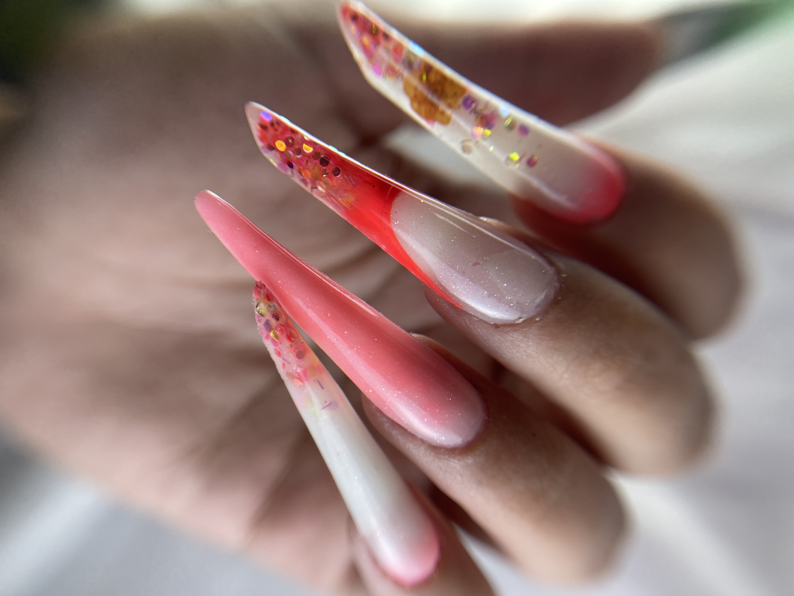 کاشتهای ژورنالی